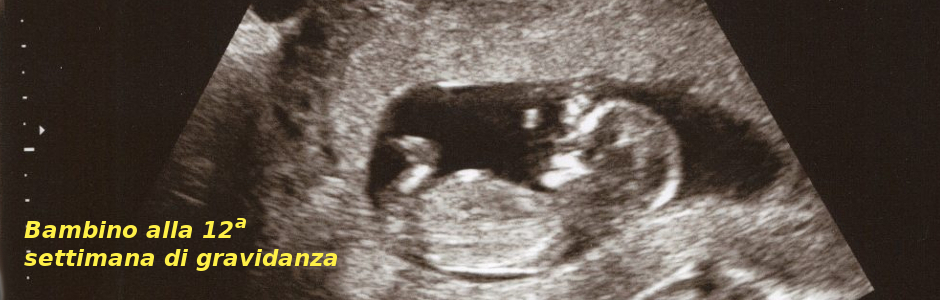 12-weeks-pregnant-ultrasound