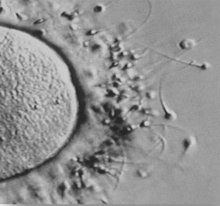 Fecondazione in vitro (FIVET)